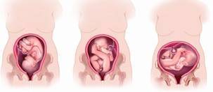 Положение и предлежание плода при беременности: тазовое, головное, поперечное, …