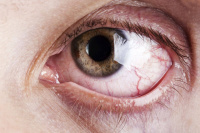 Современные методы скрининга глазных заболеваний