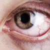 Современные методы скрининга глазных заболеваний