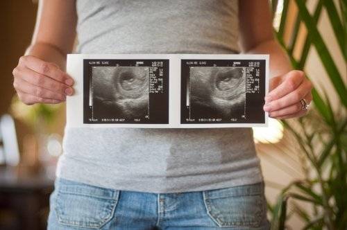 3 месяц беременности фото живота  