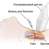 Как делают биопсию щитовидной железы